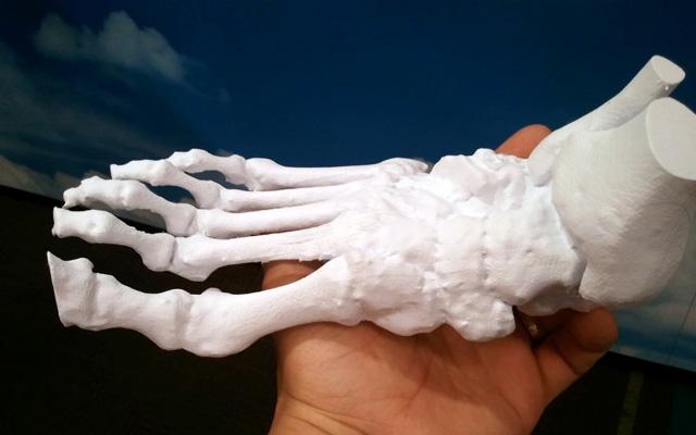 3d打印應(yīng)用領(lǐng)域之醫(yī)療應(yīng)用_e鍵打印服務(wù)公司 3d打印應(yīng)用領(lǐng)域之醫(yī)療應(yīng)用_e鍵打印服務(wù)公司