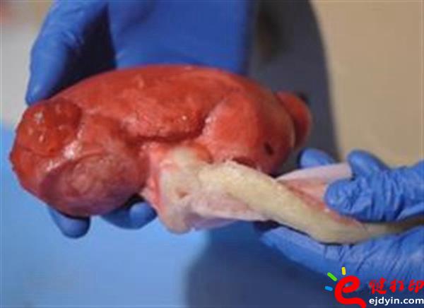 [3d打印醫(yī)療]醫(yī)生手術(shù)磨刀石 仿生3D打印心臟及人體器官